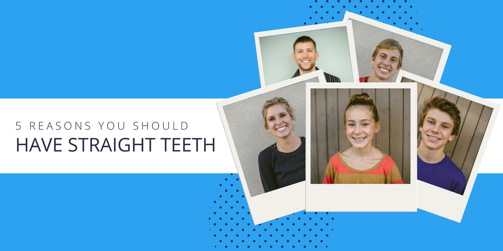 5-reasons-you-should-have-straight-teeth-1