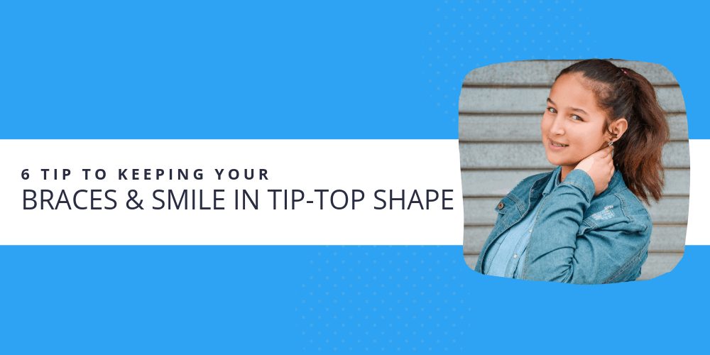 smile in tip top shape