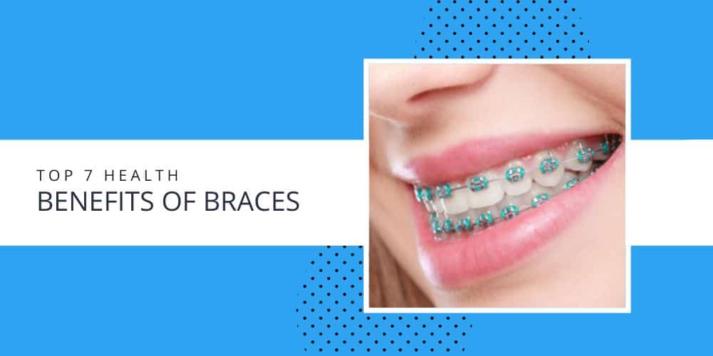 Top benefits of wearing invisible braces - Ridgetop Dental