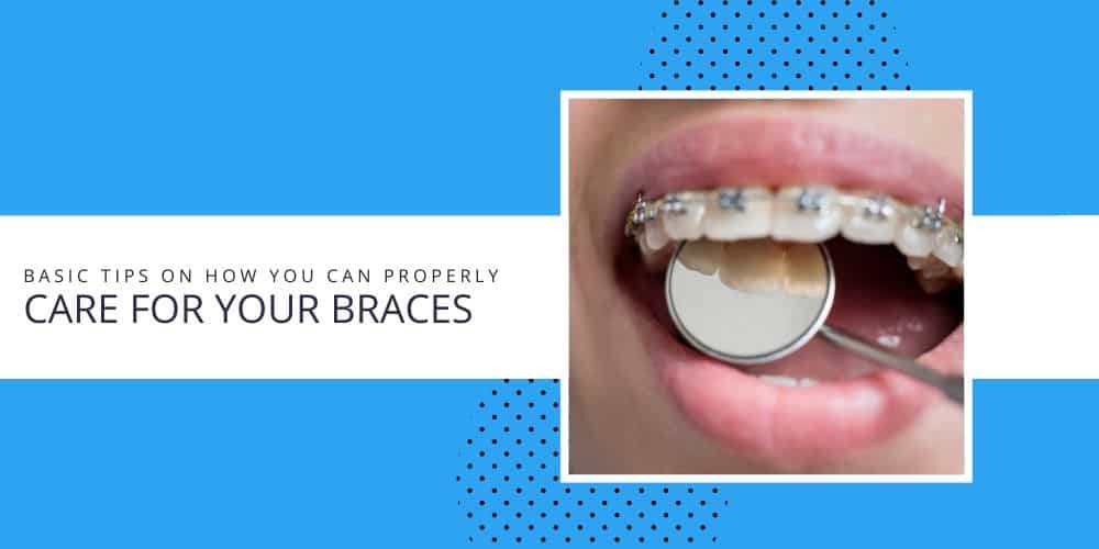 properly-care-for-your-braces