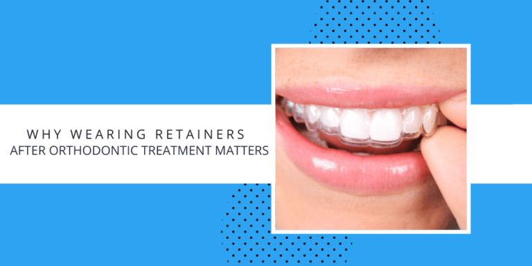 retainers